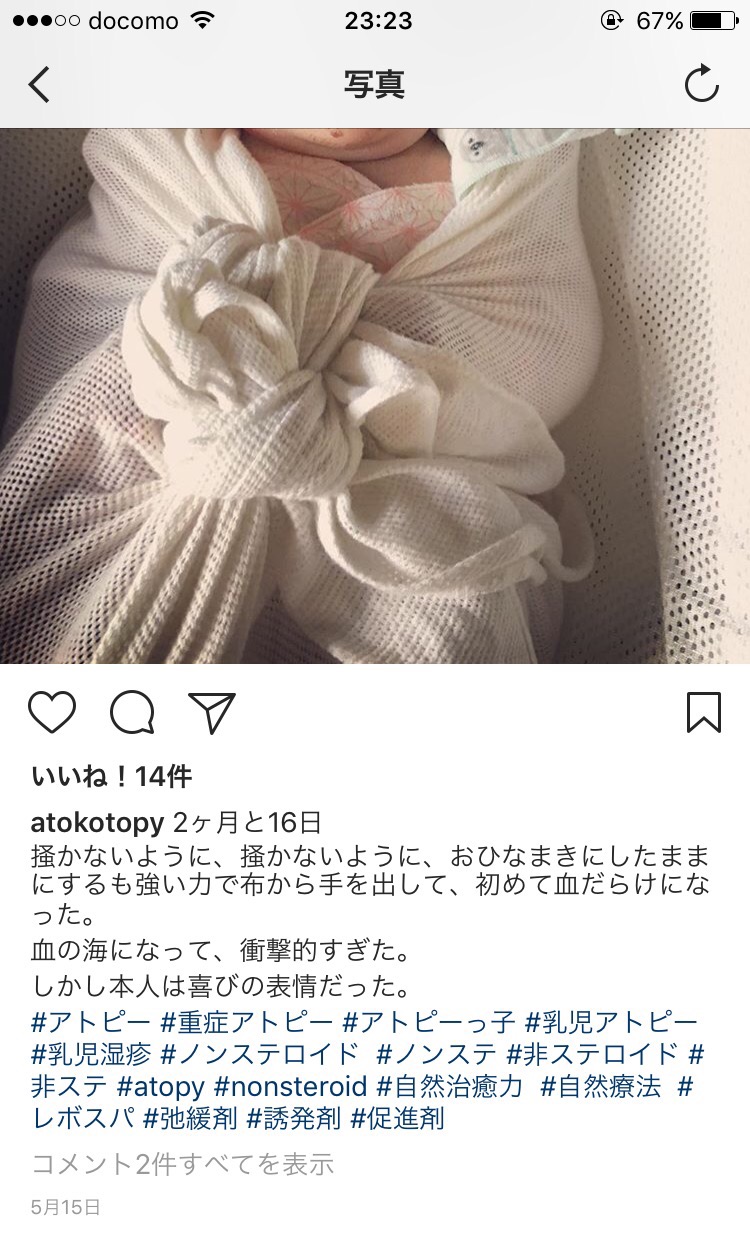 【悲報】まんこ(28)「かわいい赤ちゃんですね！抱っこさせてください！」→「オラァ！！」ﾎﾞｷﾎﾞｷ\n_5