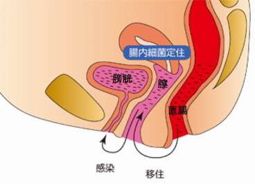 【悲報】医師「大腸菌が膣に入り込み起こる膀胱炎は女性の8割が経験する。」😲  [518915984]
_24_24
